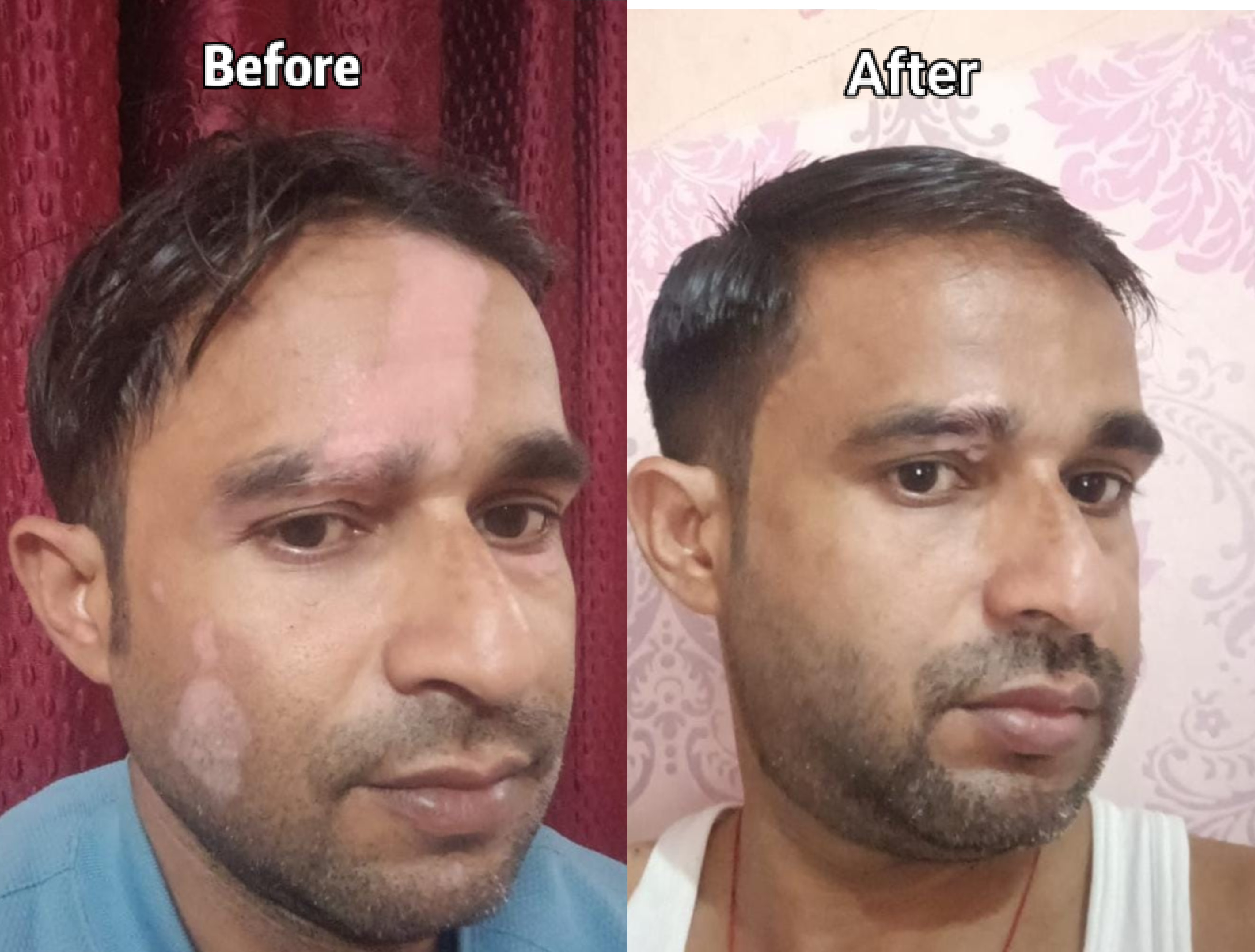 Patient before and after photo 3