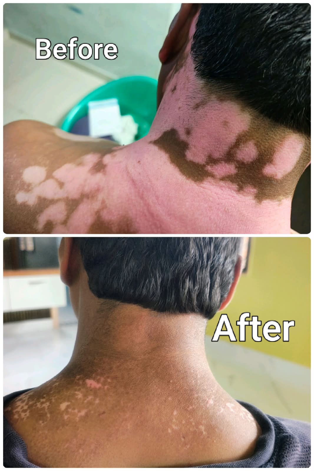 Patient before and after photo 1