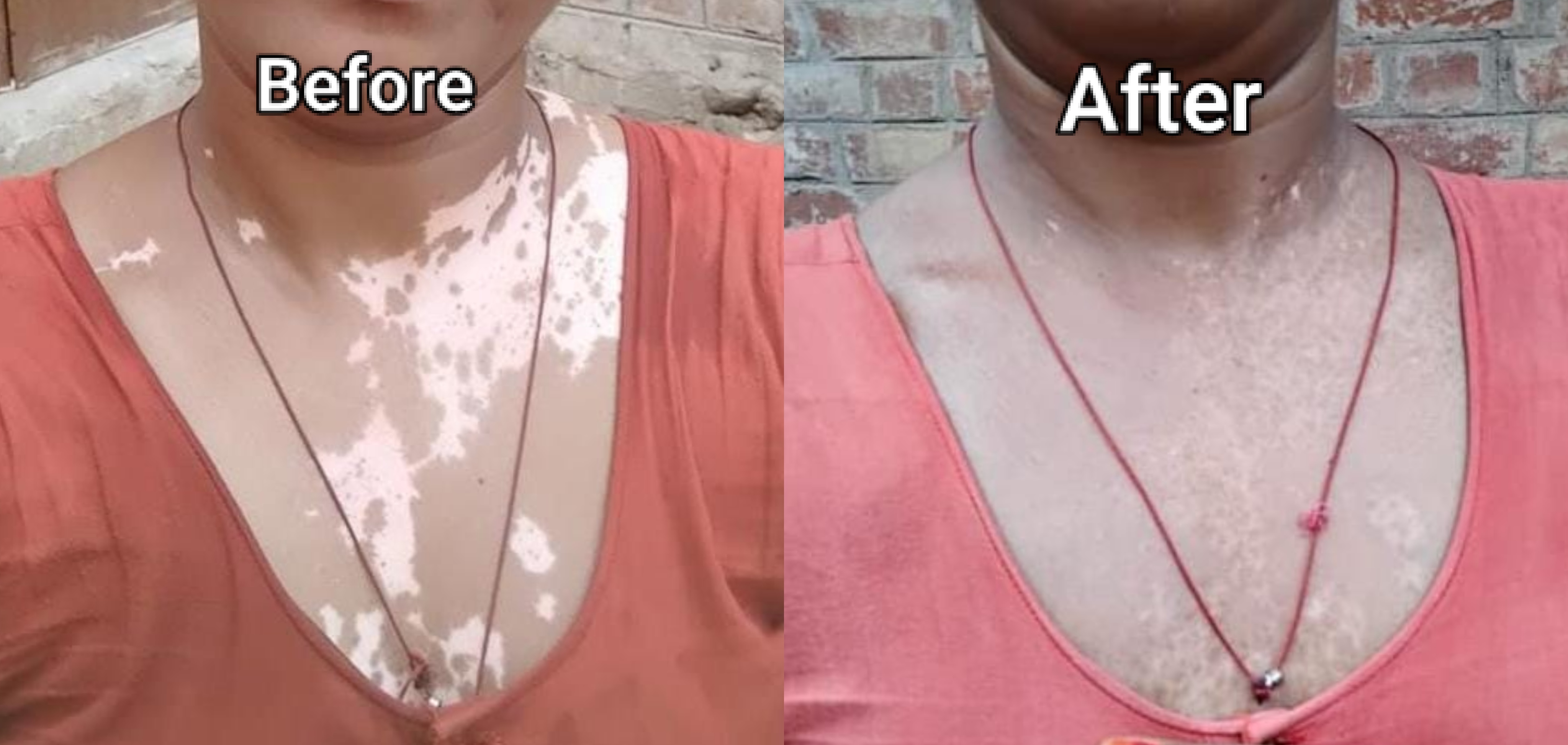 Patient before and after photo 2